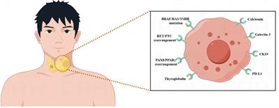 Advances in targeted therapy and biomarker research in thyroid cancer